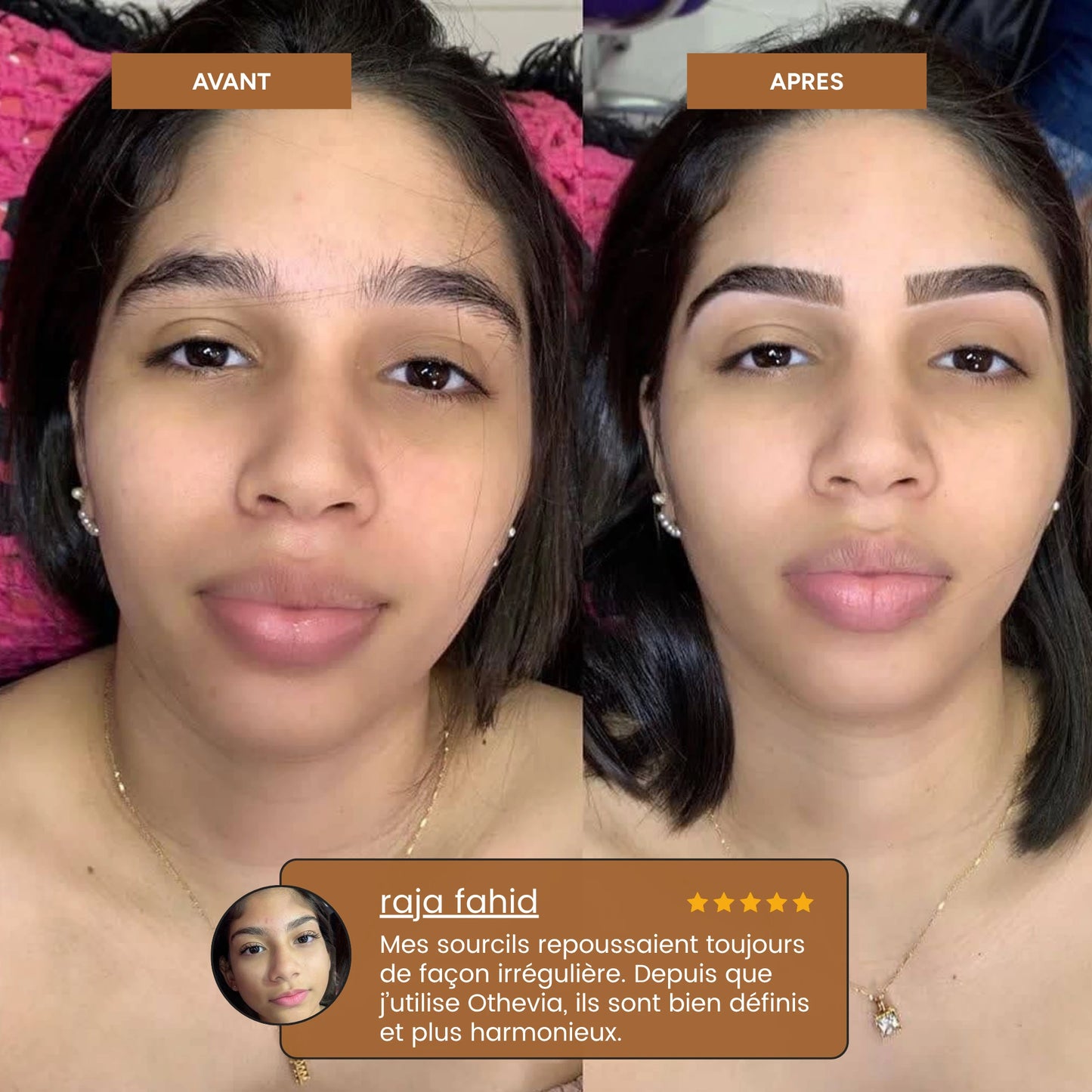 othevia elite 360| Epilateur facial