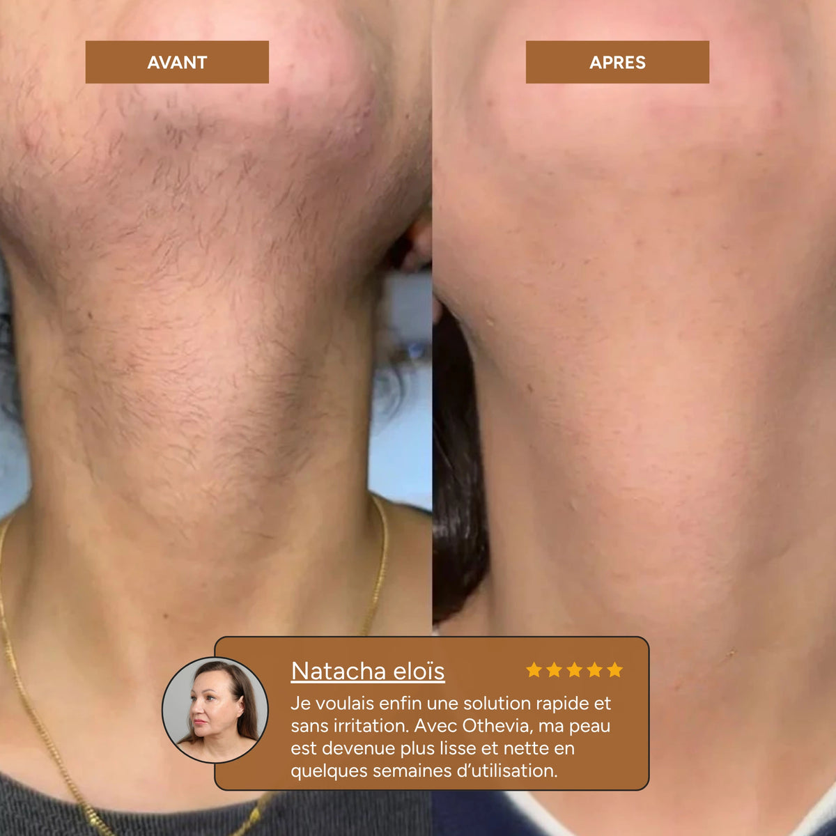 othevia elite 360| Epilateur facial